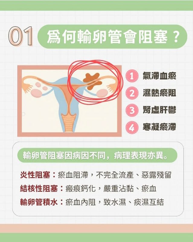 ✨【好孕分享♥】備孕女士輸卵管阻塞,經中醫治療5個月迎來好孕✨